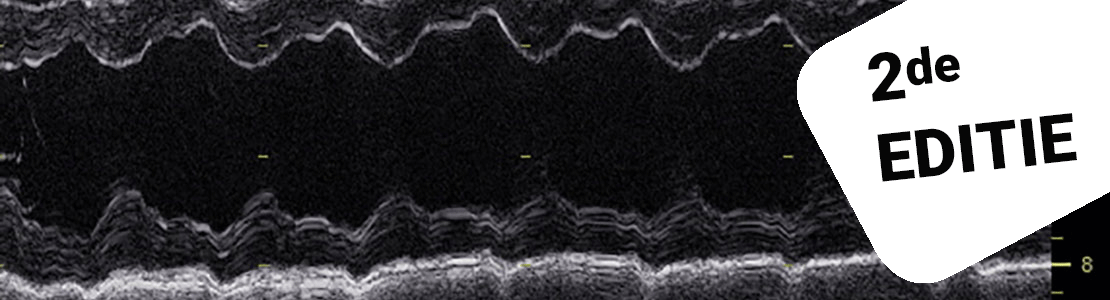 Inleiding tot de echocardiografie - Editie 1