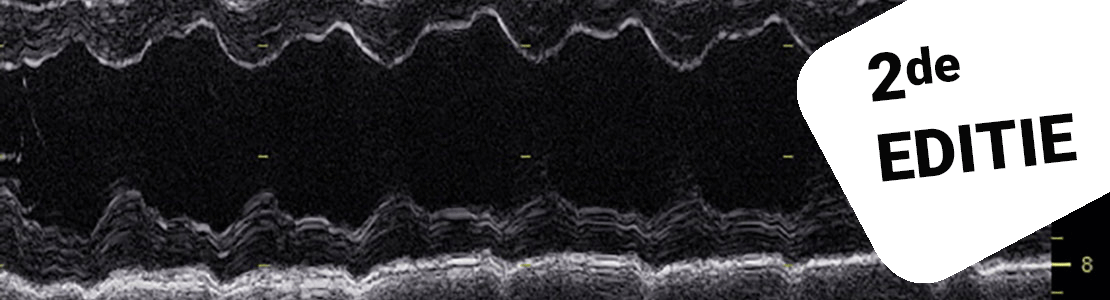 Inleiding tot de echocardiografie - Editie 2