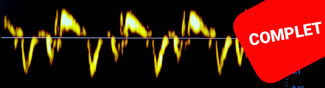 Perfectionner ma pratique en échocardiographie au quotidien - Edition 1